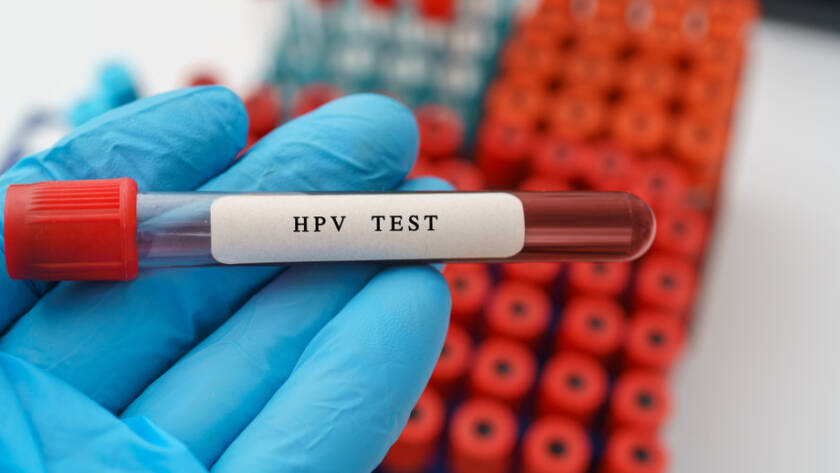 HPV test result with blood sample in test tube on doctor hand  in medical lab